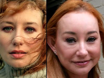 The Mutilation Of Tori Amos S Face